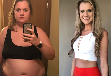 Carrie M. before and after